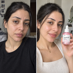 Medicube PDRN Serum